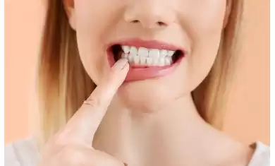 Diş Etlerim Çekiliyor!